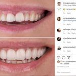 ortodoncia en barcelona